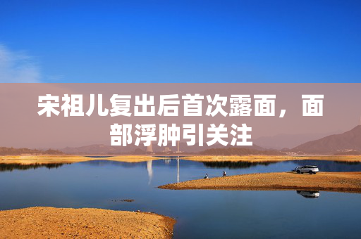 宋祖儿复出后首次露面，面部浮肿引关注