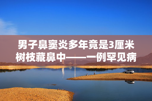 男子鼻窦炎多年竟是3厘米树枝藏鼻中——一例罕见病例的深度解析