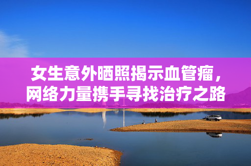女生意外晒照揭示血管瘤，网络力量携手寻找治疗之路